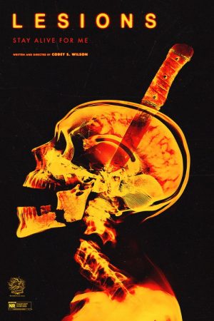 Lesions (2026) poster