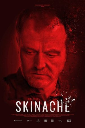 Skinache (2017) poster