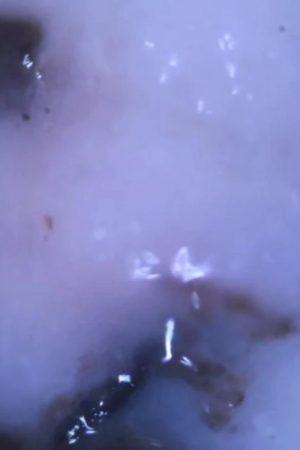 myxoInVitro00 (2016) poster