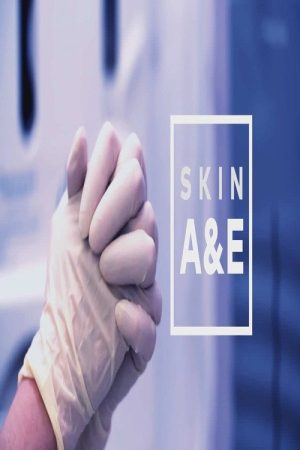 SKIN A&E (2022) poster