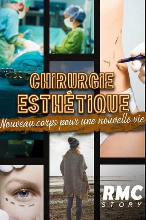 Chirurgie esthétique : nouveau corps pour une nouvelle vie (2023) poster
